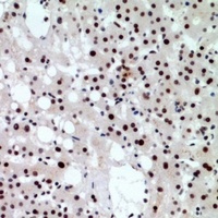 CHD4 Rabbit Polyclonal Antibody
