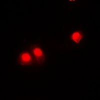 CHD4 Rabbit Polyclonal Antibody