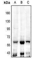 TEAD2 Rabbit Polyclonal Antibody