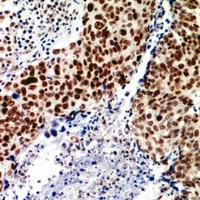 TEAD2 Rabbit Polyclonal Antibody