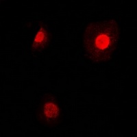 TEAD2 Rabbit Polyclonal Antibody