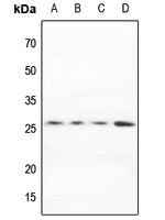 MARCH2 Rabbit Polyclonal Antibody