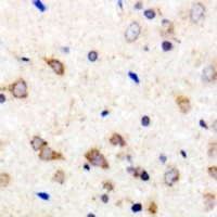 MARCH2 Rabbit Polyclonal Antibody