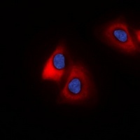 MARCH2 Rabbit Polyclonal Antibody