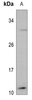 MYCBP Rabbit Polyclonal Antibody