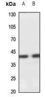 SETMAR Rabbit Polyclonal Antibody