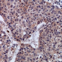 SETMAR Rabbit Polyclonal Antibody