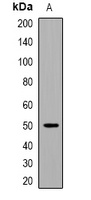 EEF1A (Acetyl-K146) Rabbit Polyclonal Antibody