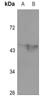 MEF2A (Acetyl-K403) Rabbit Polyclonal Antibody