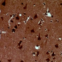 Alpha-synuclein (Phospho-Y125) Rabbit Polyclonal Antibody