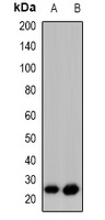 GAP43 (Phospho-S41) Rabbit Polyclonal Antibody