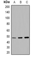 MMP13 Rabbit Polyclonal Antibody