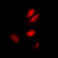 ASF1A Rabbit Polyclonal Antibody