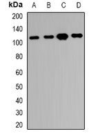 RBM26 Rabbit Polyclonal Antibody