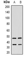 ITPK1 Rabbit Polyclonal Antibody