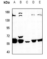 K Cadherin Rabbit Polyclonal Antibody