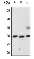 Latexin Rabbit Polyclonal Antibody