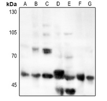 CD126 Antibody