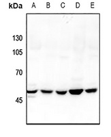 GDI2 Rabbit Polyclonal Antibody