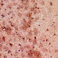 GDI2 Rabbit Polyclonal Antibody