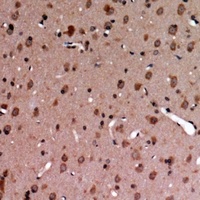 MERTK/TYRO3 (Phospho-Y749/681) Antibody