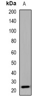 SEC22B Rabbit Polyclonal Antibody