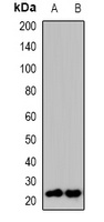RHEB Rabbit Polyclonal Antibody
