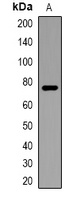 ACSS1 Rabbit Polyclonal Antibody