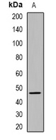 E2F1 Rabbit Polyclonal Antibody