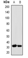 PP5 Rabbit Polyclonal Antibody