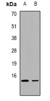 FABP2 Rabbit Polyclonal Antibody