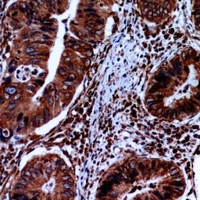 FABP2 Rabbit Polyclonal Antibody