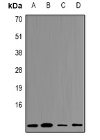 Cystatin A Rabbit Polyclonal Antibody