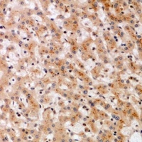 SOCS2 Antibody