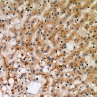 CD265 Antibody
