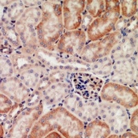 Galectin 1 Antibody