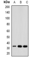 CDK6 Rabbit Polyclonal Antibody