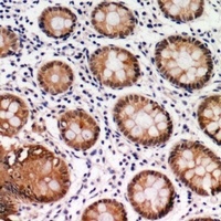 CDK6 Rabbit Polyclonal Antibody