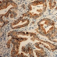 CD49b Rabbit Polyclonal Antibody