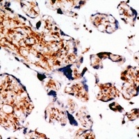 TGFBR3 Antibody