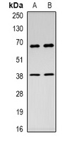 c-Rel Rabbit Polyclonal Antibody