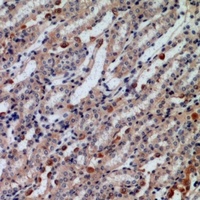 Caldesmon Rabbit Polyclonal Antibody
