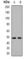 HIC5 Rabbit Polyclonal Antibody