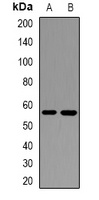 IL-17RB Antibody