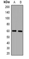 ZFP91 Rabbit Polyclonal Antibody