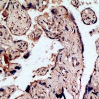 Endothelin B Receptor Rabbit Polyclonal Antibody