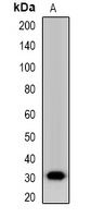 Nanos 1 Rabbit Polyclonal Antibody