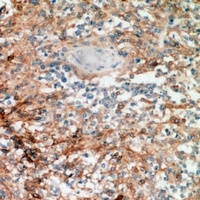 Nanos 1 Rabbit Polyclonal Antibody