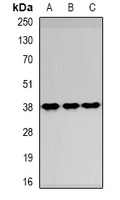SPFH1 Rabbit Polyclonal Antibody