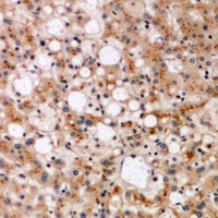SPFH1 Rabbit Polyclonal Antibody